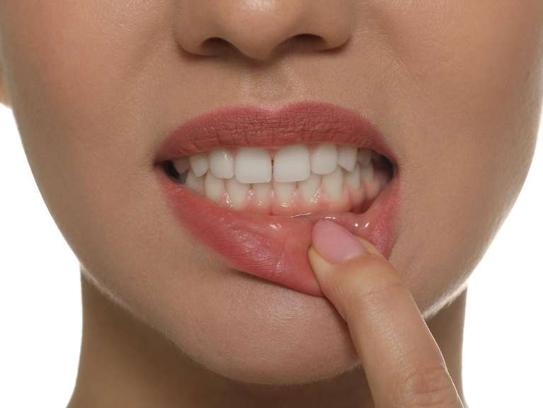 Gum Disease Treatment in Annapolis, MD