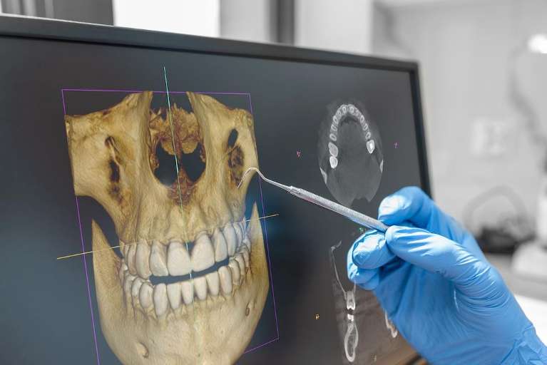 3-D Cone Beam Imaging